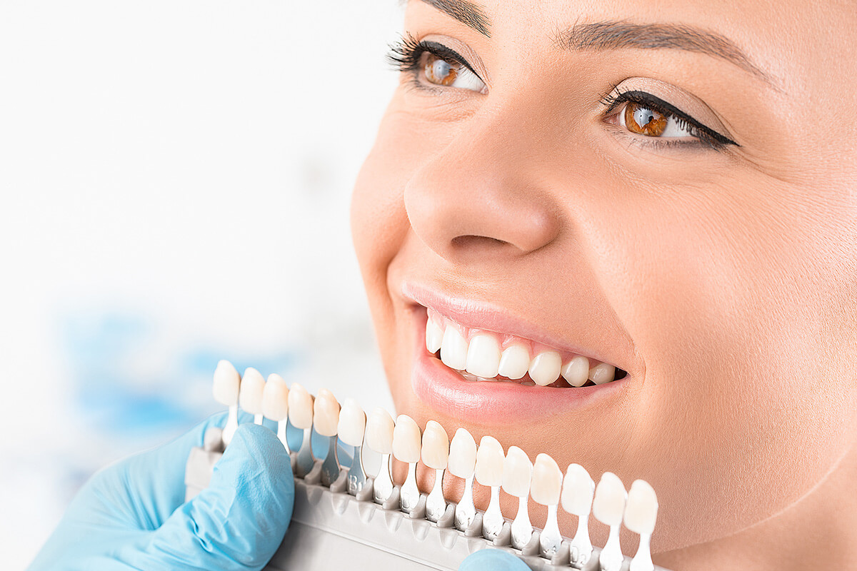 How Much Does A Teeth Cleaning Cost in Montgomery, AL?